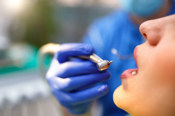 Best Veneers and Lumineers  in Lla Lla East, WA